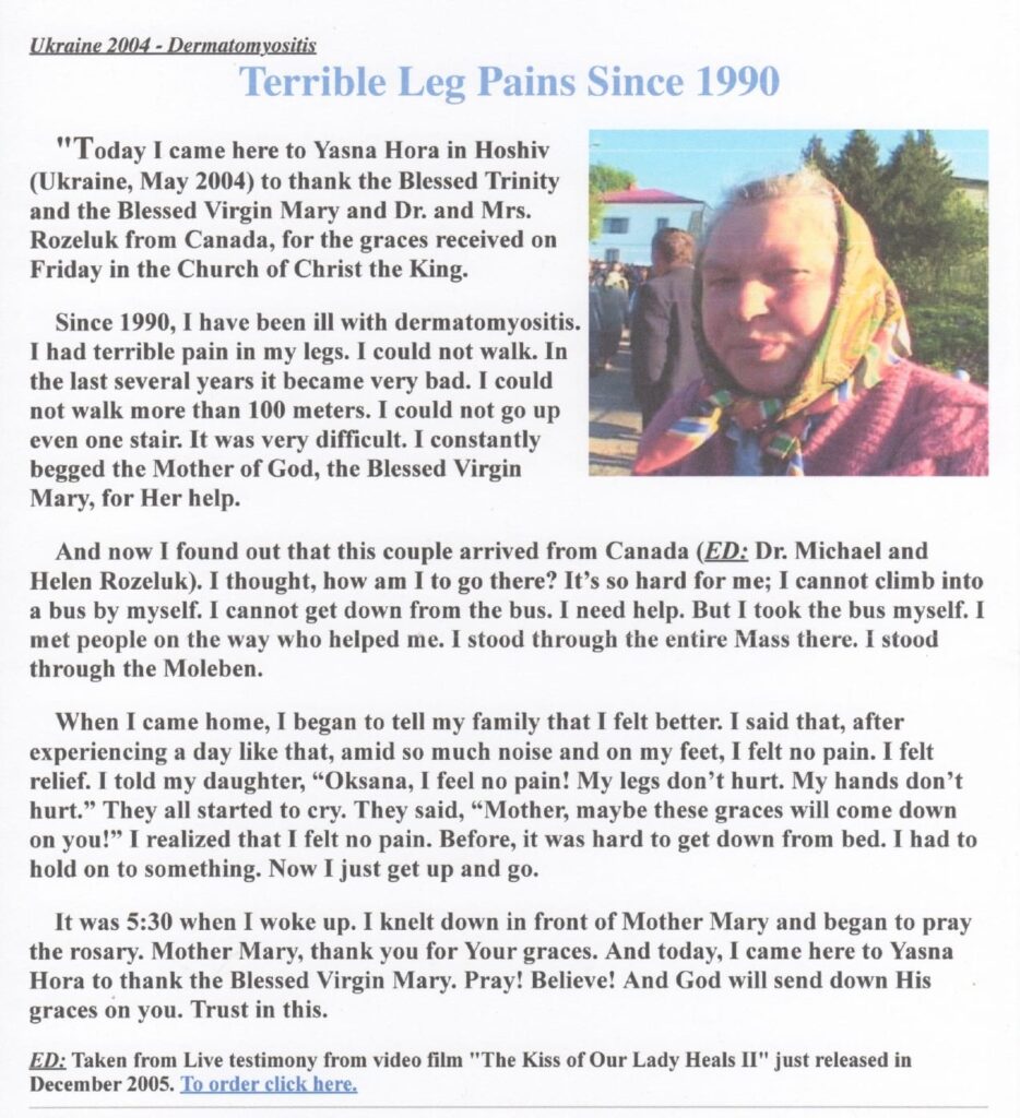 Testimonial on healing from leg pain since 1990.
